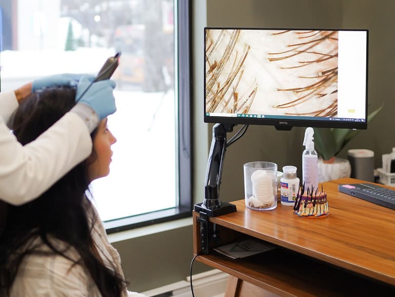 Consultation en trichologie