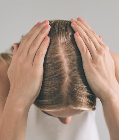 Perte de cheveux chez la femme