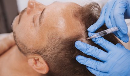 Homme recevant une injection de plasma riche en plaquettes pour les cheveux